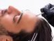 Affordable and Advanced FUE Hair Transplant treatments with promising results -Vigorcolumn