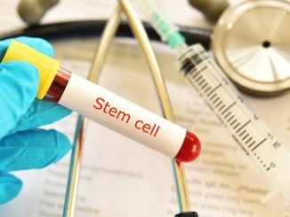Stem cell therapy for vascular disease can be predicted through real-time observation