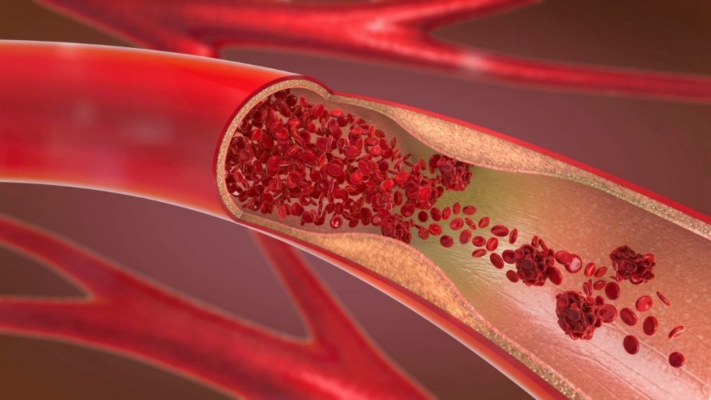 Stem cell therapy for vascular disease  can be predicted through real-time observation