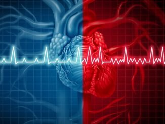 Atrial Fibrillation : One small alcoholic drink a day is linked to an increased risk of atrial fibrillation