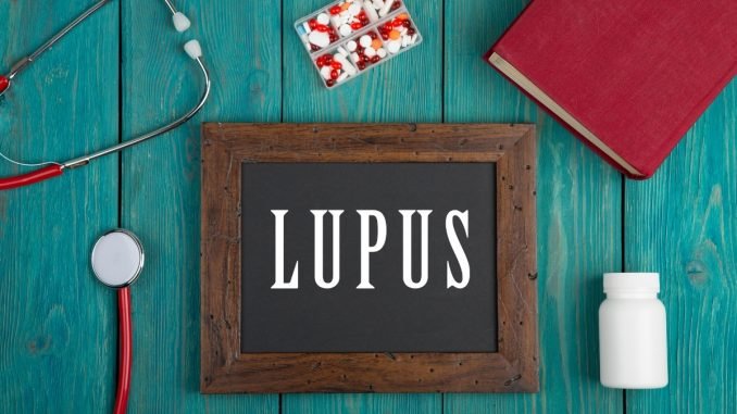 Lupus, an autoimmune disease that can cause inflammation of the joints, skin, kidneys, blood cells, brain, heart and lungs, is caused when the immune system attacks its own tissue.