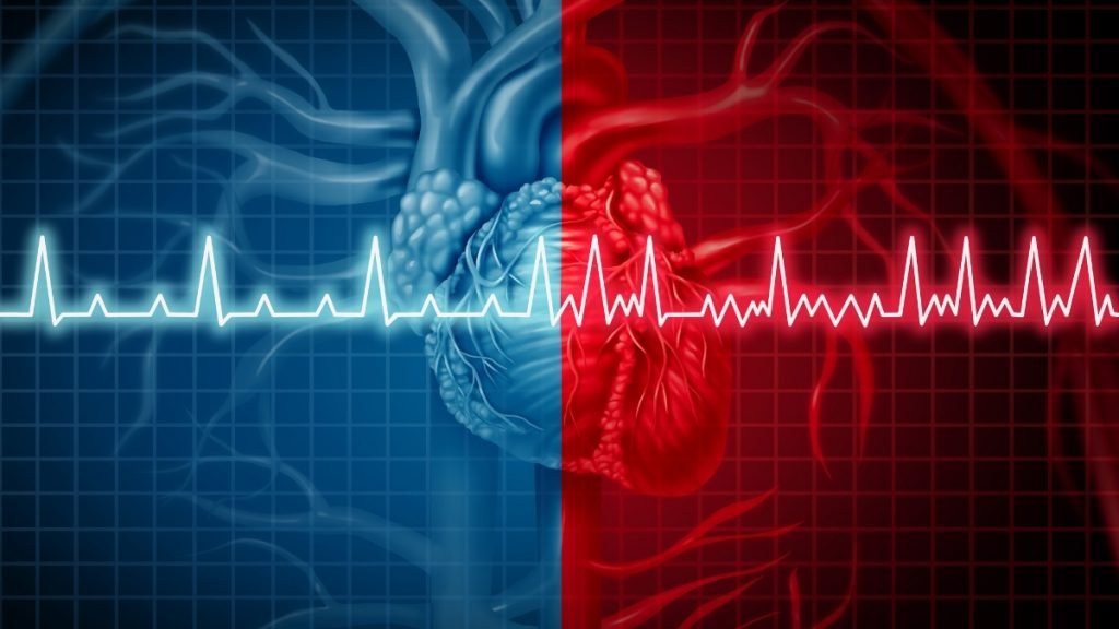 High Blood Pressure May Causes Atrial Fibrillation